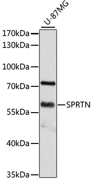 Western blot - SPRTN Polyclonal Antibody 