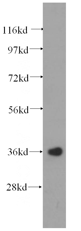 human stomach tissue were subjected to SDS PAGE followed by western blot with Catalog No:110187(EIF2S1 antibody) at dilution of 1:500