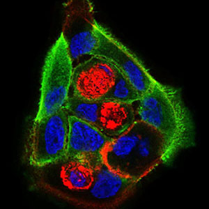 Immunofluorescence analysis of MCF-7 cells using PRL mouse mAb (green). Blue