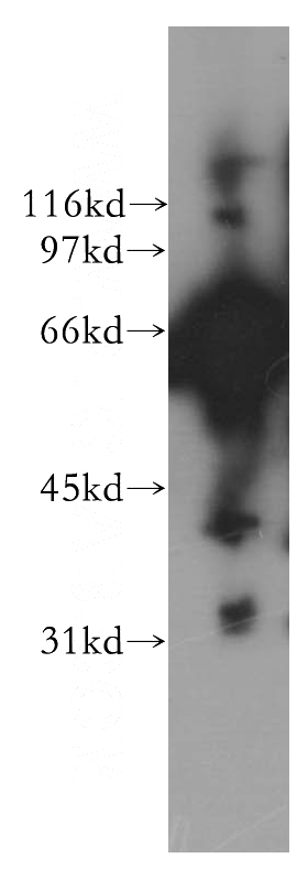 human brain tissue were subjected to SDS PAGE followed by western blot with Catalog No:107926(AK5 antibody) at dilution of 1:300