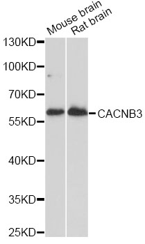 Western blot - CACNB3 Polyclonal Antibody 