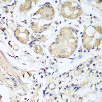 Immunohistochemistry - NID1 Polyclonal Antibody 