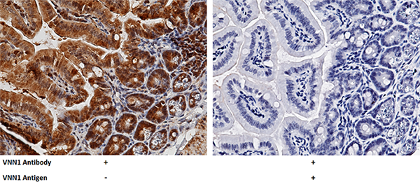 VNN1 / Vanin-1 Antibody, Rabbit PAb, Antigen Affinity Purified, Immunohistochemistry