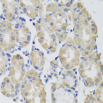 Immunohistochemistry - GPT Polyclonal Antibody 