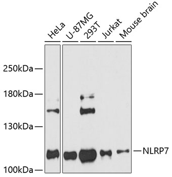 Western blot - NLRP7 Polyclonal Antibody 