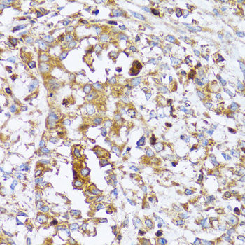 Immunohistochemistry - ACTR2 Polyclonal Antibody 