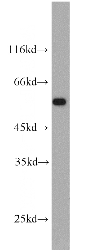 A549 cells were subjected to SDS PAGE followed by western blot with Catalog No:111629(IFNGR2 antibody) at dilution of 1:500