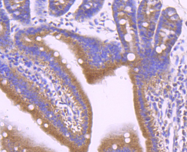 Fig8:; Immunohistochemical analysis of paraffin-embedded mouse small intestine tissue using anti-Leptin Receptor antibody. The section was pre-treated using heat mediated antigen retrieval with Tris-EDTA buffer (pH 8.0-8.4) for 20 minutes.The tissues were blocked in 5% BSA for 30 minutes at room temperature, washed with ddH; 2; O and PBS, and then probed with the primary antibody ( 1/50) for 30 minutes at room temperature. The detection was performed using an HRP conjugated compact polymer system. DAB was used as the chromogen. Tissues were counterstained with hematoxylin and mounted with DPX.