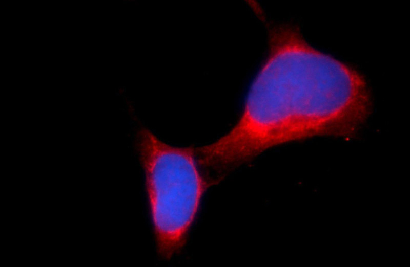 Immunofluorescent analysis of HEK-293 cells using Catalog No:109772(DDHD2 Antibody) at dilution of 1:25 and Alexa Fluor 594-congugated AffiniPure Goat Anti-Rabbit IgG(H+L)