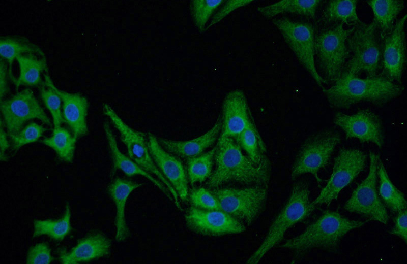 Immunofluorescent analysis of SH-SY5Y cells using Catalog No:109509(CPLX1 Antibody) at dilution of 1:25 and Alexa Fluor 488-congugated AffiniPure Goat Anti-Rabbit IgG(H+L)