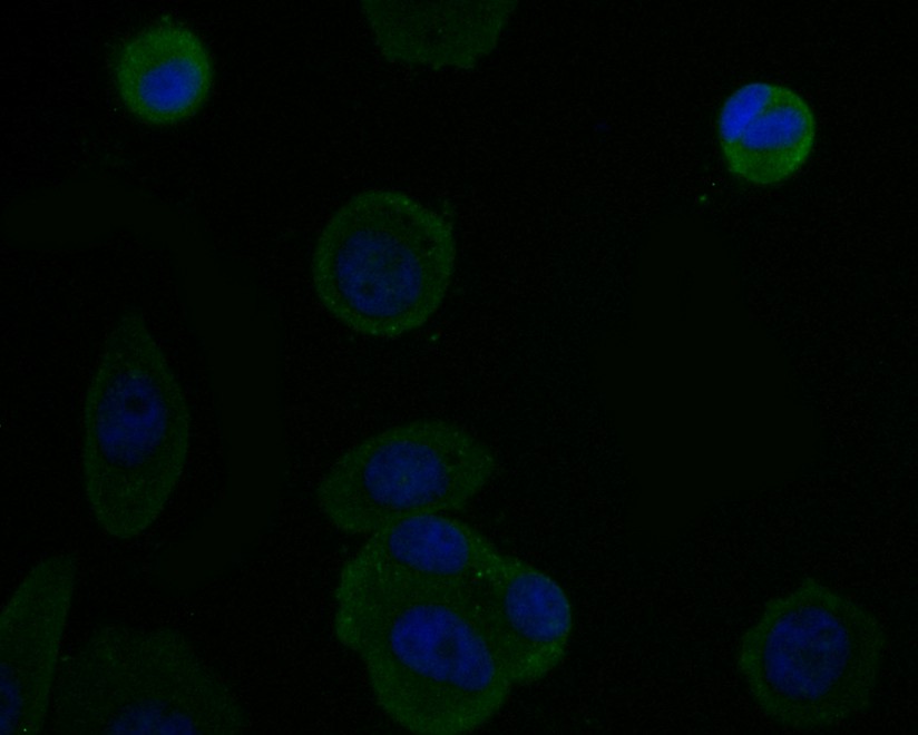Fig2: ICC staining Osteoproteger in MCF-7 cells (green). The nuclear counter stain is DAPI (blue). Cells were fixed in paraformaldehyde, permeabilised with 0.25% Triton X100/PBS.