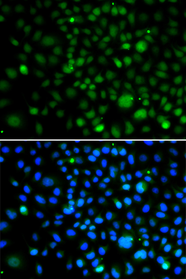 Immunofluorescence - KLF15 Polyclonal Antibody 