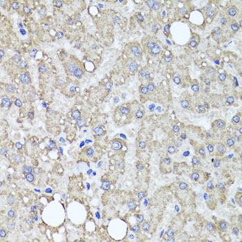Immunohistochemistry - MUC16 Polyclonal Antibody 
