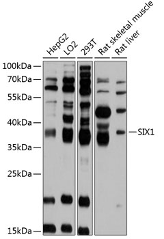Western blot - SIX1 Polyclonal Antibody 