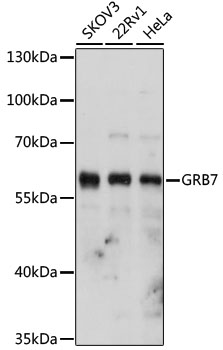 Western blot - GRB7 Polyclonal Antibody 