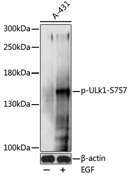 Western blot - Phospho-ULk1-S757 pAb 