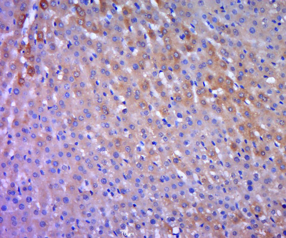 Fig5: Paraformaldehyde-fixed, paraffin embedded (rat liver tissue); Antigen retrieval by boiling in sodium citrate buffer (pH6.0) for 15min; Block endogenous peroxidase by 3% hydrogen peroxide for 20 minutes; Blocking buffer (normal goat serum) at 37℃ for 30min; Antibody incubation with (ODC) Polyclonal Antibody, Unconjugated at 1:400 overnight at 4℃, followed by a conjugated secondary (sp-0023) for 20 minutes and DAB staining.