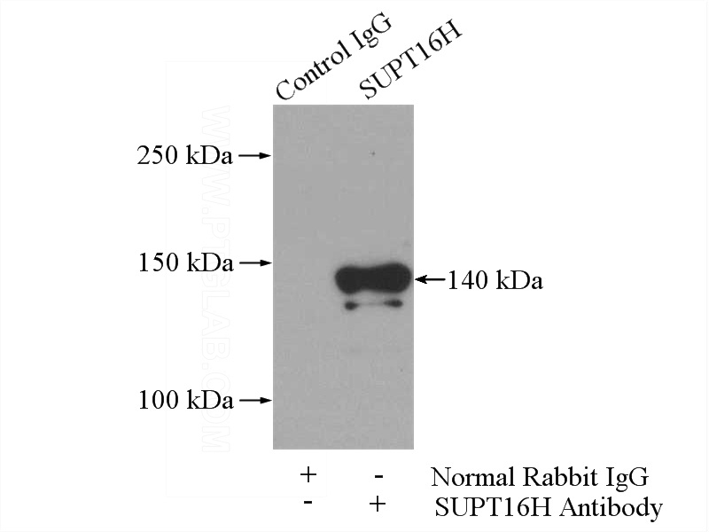 IP Result of anti-SUPT16H (IP:Catalog No:115841, 4ug; Detection:Catalog No:115841 1:1000) with mouse brain tissue lysate 3440ug.
