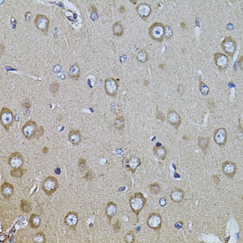 Immunohistochemistry - ITGB8 Polyclonal Antibody 