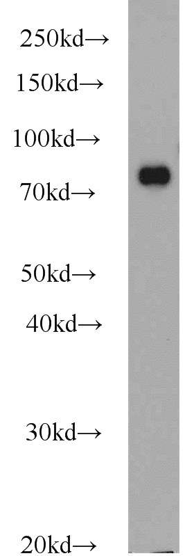 HeLa cells were subjected to SDS PAGE followed by western blot with Catalog No:111571(HSP90AB1 antibody) at dilution of 1:1000