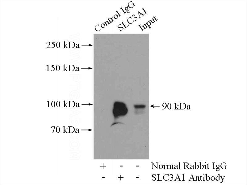 IP Result of anti-SLC3A1 (IP:Catalog No:115376, 4ug; Detection:Catalog No:115376 1:1000) with mouse kidney tissue lysate 4000ug.