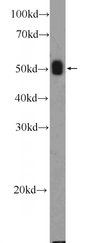 mouse skeletal muscle tissue were subjected to SDS PAGE followed by western blot with Catalog No:113335(OGG1 Antibody) at dilution of 1:600