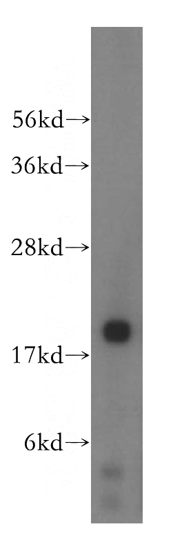 HeLa cells were subjected to SDS PAGE followed by western blot with Catalog No:112963(NAT5 antibody) at dilution of 1:500
