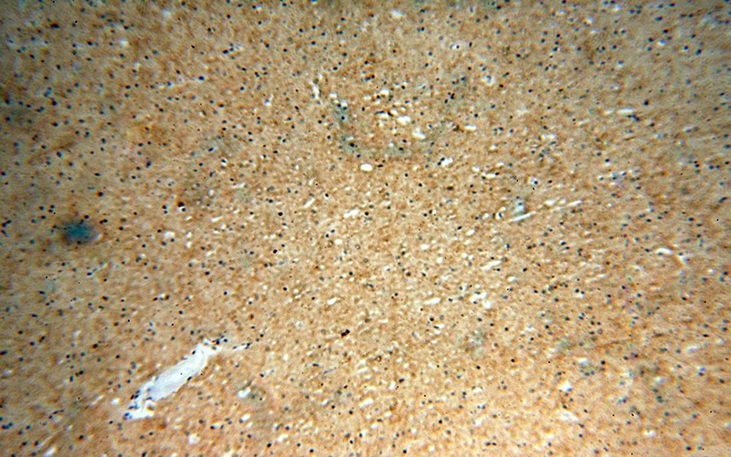 Immunohistochemical of paraffin-embedded human brain using Catalog No:116561(UGT8 antibody) at dilution of 1:100 (under 10x lens)