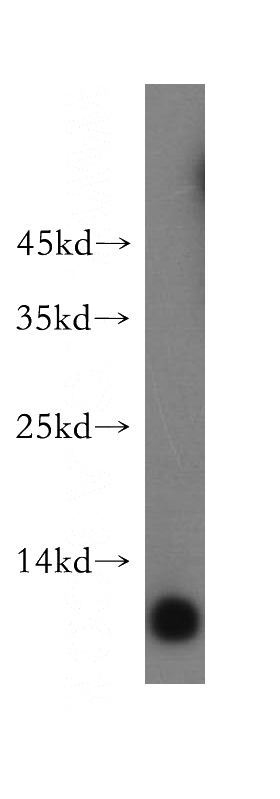 HEK-293 cells were subjected to SDS PAGE followed by western blot with Catalog No:109332(CKS2 antibody) at dilution of 1:300