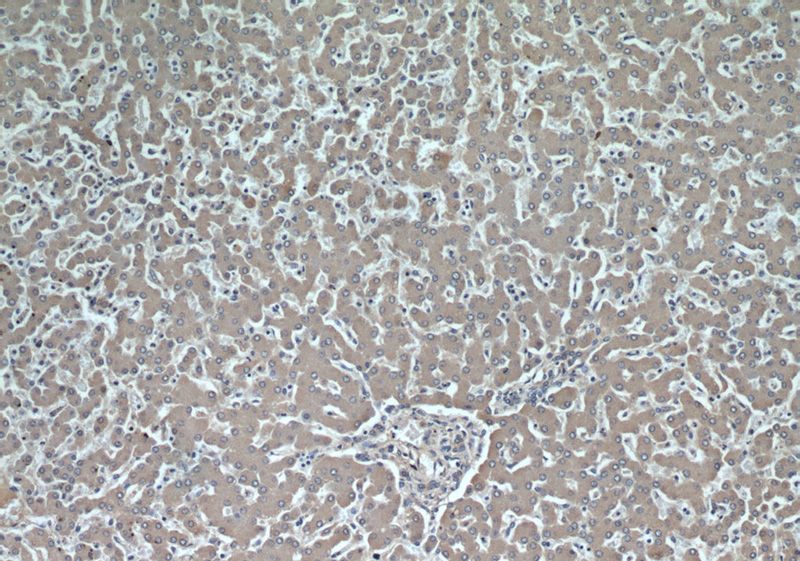 Immunohistochemical of paraffin-embedded human liver using Catalog No:107574(SERPINA3,AACT antibody) at dilution of 1:50 (under 10x lens)
