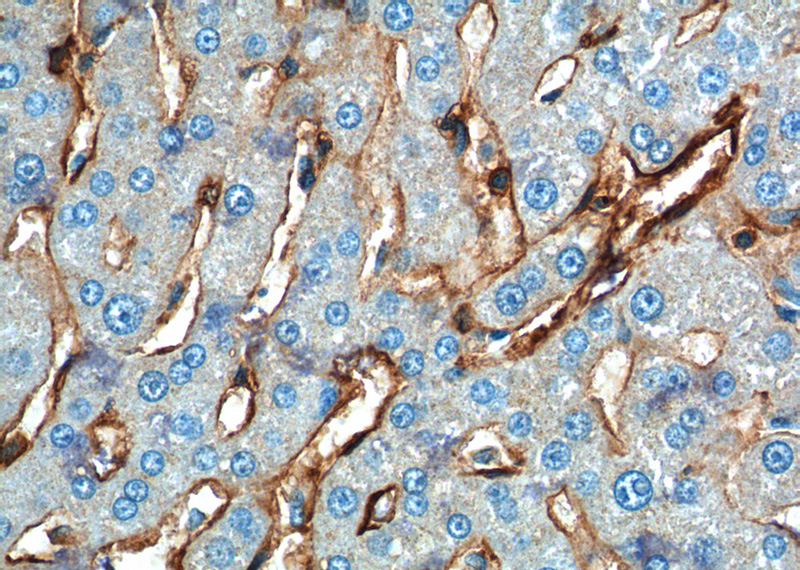 Immunohistochemistry of paraffin-embedded human liver tissue slide using Catalog No:108093(Annexin A2 Antibody) at dilution of 1:200 (under 40x lens).