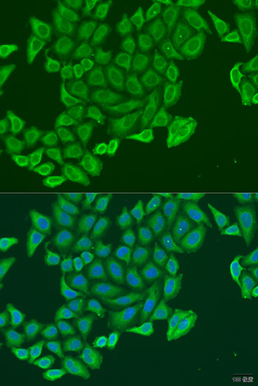 Immunofluorescence - EXOC2 Polyclonal Antibody 