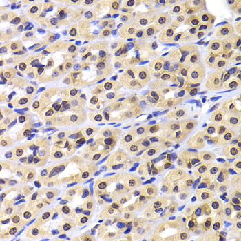Immunohistochemistry - NUDC Polyclonal Antibody 