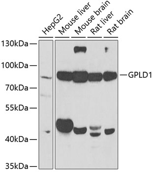 Western blot - GPLD1 Polyclonal Antibody 