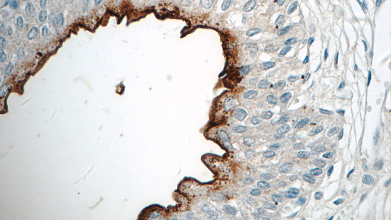 Immunohistochemistry of paraffin-embedded human bladder tissue slide using Catalog No:116630(UPK2-Specific Antibody) at dilution of 1:200 (under 40x lens)