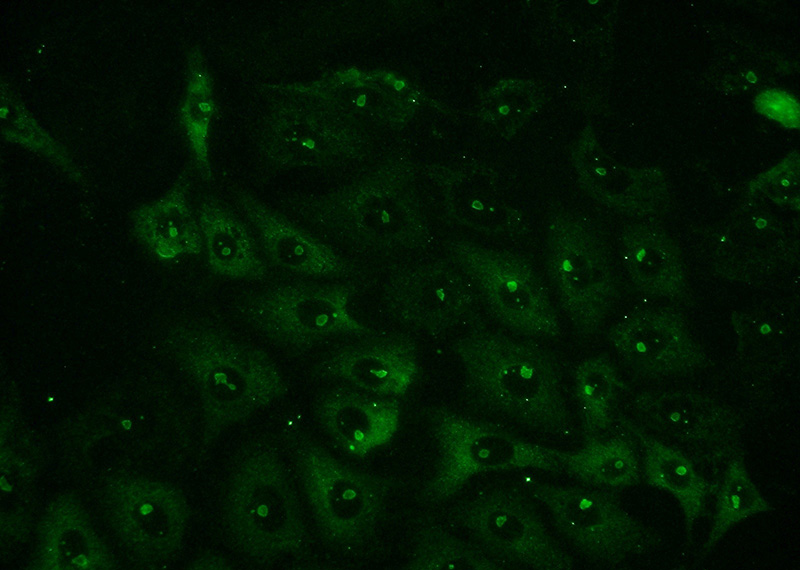 Immunofluorescent analysis of (-20oc Ethanol) fixed SH-SY5Y cells using Catalog No:113154(NFKB1 Antibody) at dilution of 1:50 and Alexa Fluor 488-congugated AffiniPure Goat Anti-Rabbit IgG(H+L)