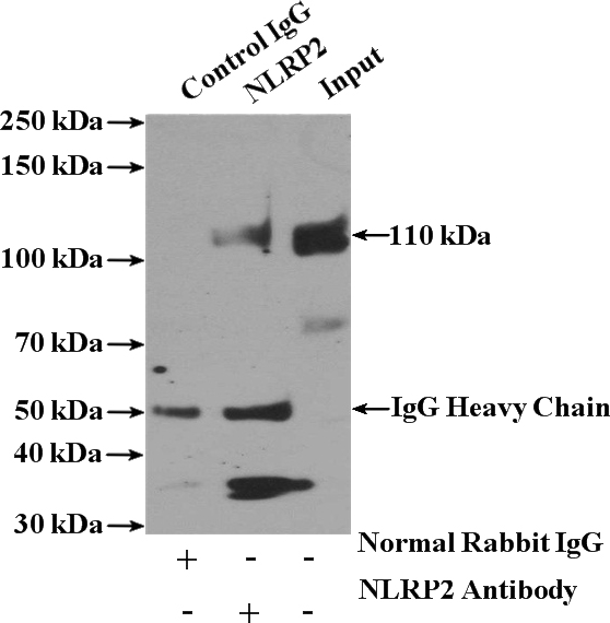 IP Result of anti-NLRP2 (IP:Catalog No:113242, 4ug; Detection:Catalog No:113242 1:500) with A549 cells lysate 400ug.