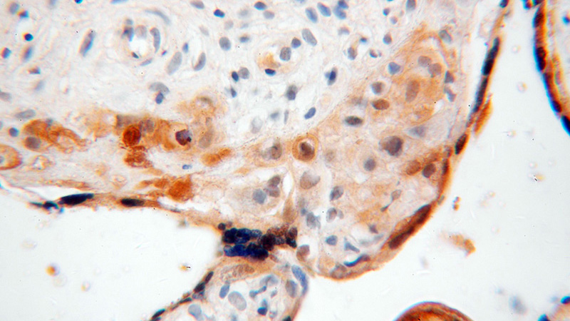 Immunohistochemical of paraffin-embedded human placenta using Catalog No:109389(CLIC3 antibody) at dilution of 1:50 (under 40x lens)