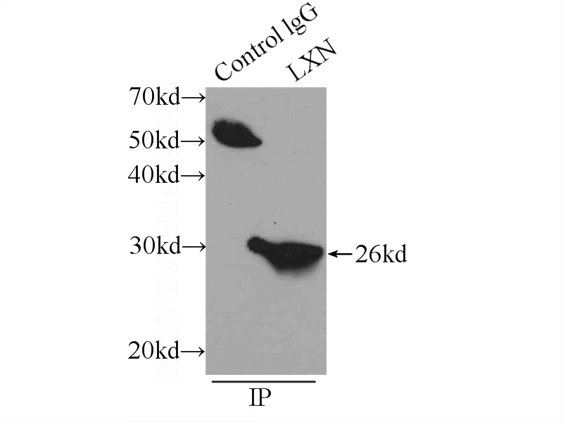 IP Result of anti-LXN (IP:Catalog No:112397, 4ug; Detection:Catalog No:112397 1:500) with mouse lung tissue lysate 5160ug.