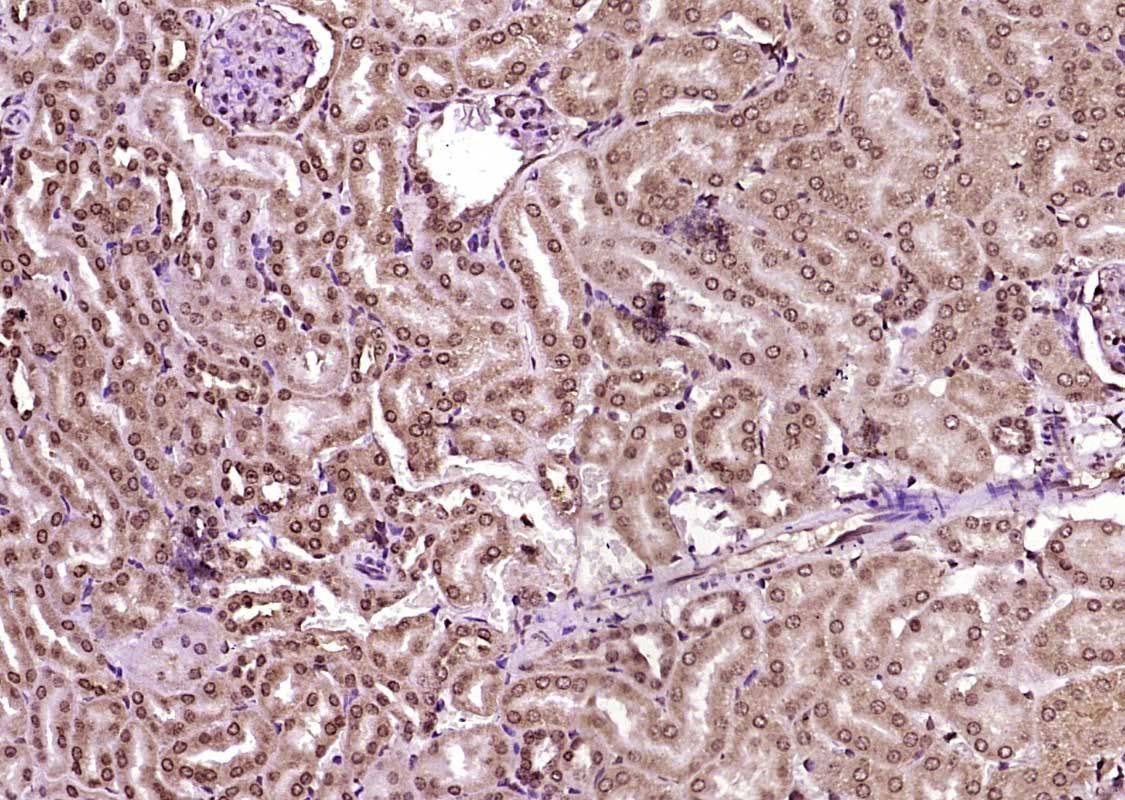 Fig4: Paraformaldehyde-fixed, paraffin embedded (Mouse kidney); Antigen retrieval by boiling in sodium citrate buffer (pH6.0) for 15min; Block endogenous peroxidase by 3% hydrogen peroxide for 20 minutes; Blocking buffer (normal goat serum) at 37℃ for 30min; Antibody incubation with (KIBRA) Polyclonal Antibody, Unconjugated at 1:400 overnight at 4℃, followed by operating according to SP Kit(Rabbit) (sp-0023) instructionsand DAB staining.