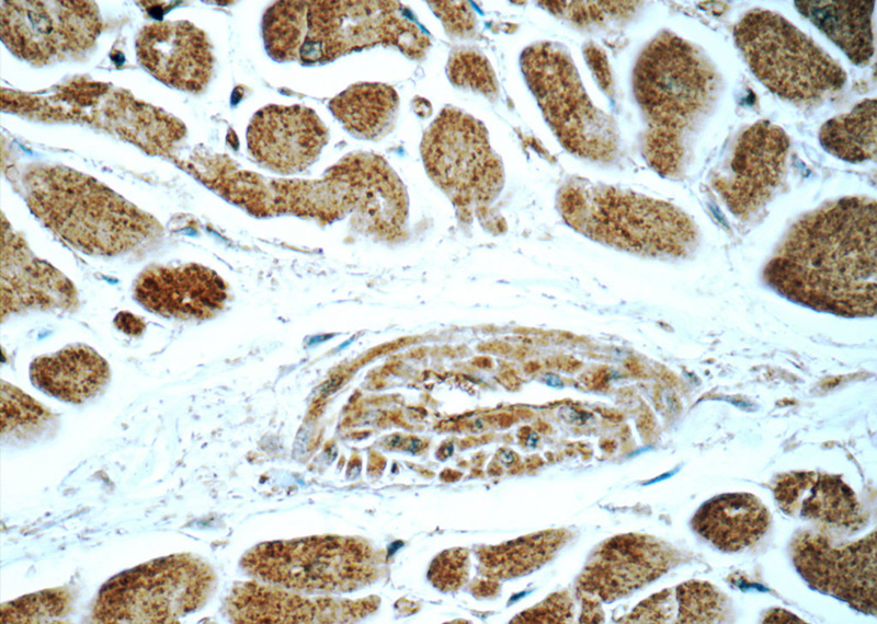 Immunohistochemistry of paraffin-embedded human heart tissue slide using Catalog No:115242(SIRT2 Antibody) at dilution of 1:50 (under 40x lens)