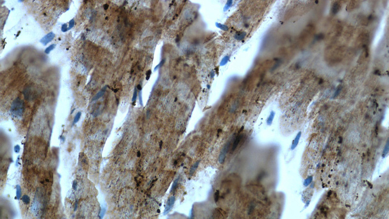 Immunohistochemistry of paraffin-embedded human heart tissue slide using Catalog No:112943(MYL3 Antibody) at dilution of 1:50 (under 40x lens)