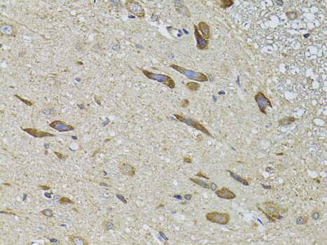Immunohistochemistry - ADRBK2 Polyclonal Antibody 