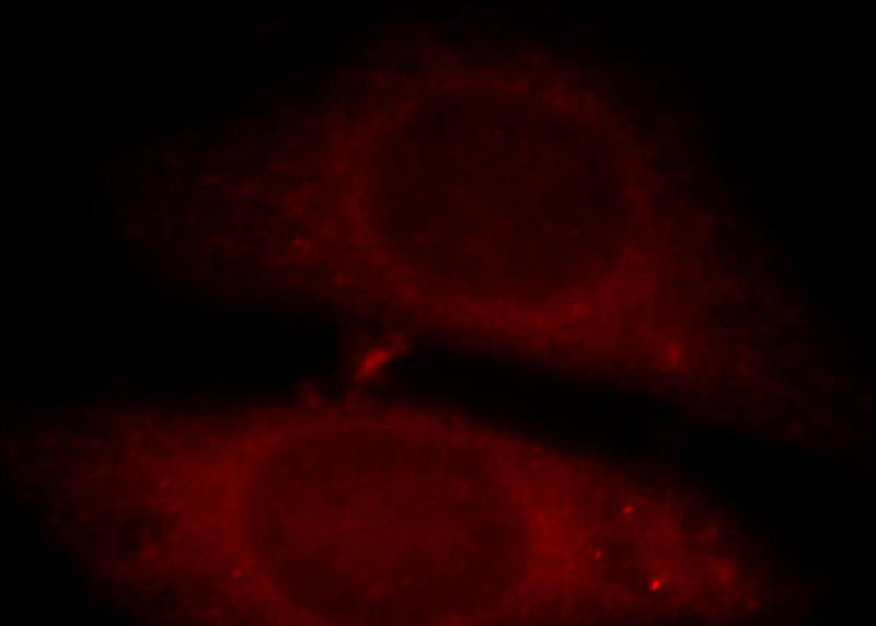 Immunofluorescent analysis of HepG2 cells, using C11orf49 antibody Catalog No:108638 at 1:25 dilution and Rhodamine-labeled goat anti-rabbit IgG (red).
