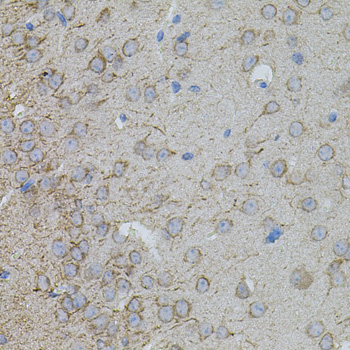 Immunohistochemistry - MMP10 Polyclonal Antibody 
