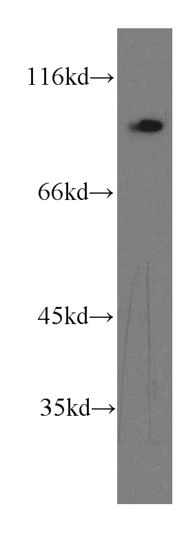 A549 cells were subjected to SDS PAGE followed by western blot with Catalog No:116075(TLR5 antibody) at dilution of 1:500