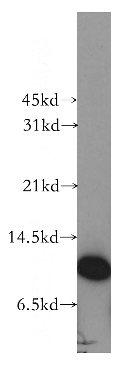 human placenta tissue were subjected to SDS PAGE followed by western blot with Catalog No:107657(CSTB antibody) at dilution of 1:1500