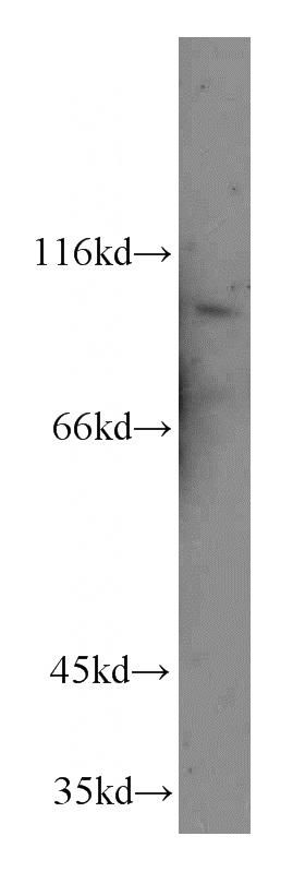 human placenta tissue were subjected to SDS PAGE followed by western blot with Catalog No:117079(AXIN2 antibody) at dilution of 1:200