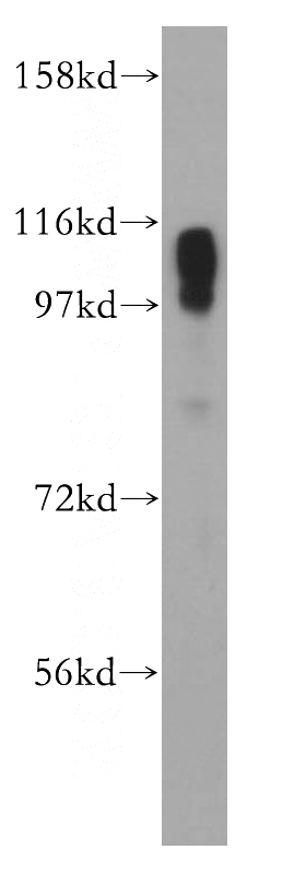 mouse heart tissue were subjected to SDS PAGE followed by western blot with Catalog No:115126(SERCA2,ATP2A2 antibody) at dilution of 1:3000