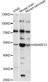 Western blot - KIAA0513 Polyclonal Antibody 
